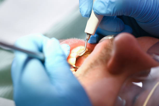 Best Emergency Denture Repair in Nescopeck, PA