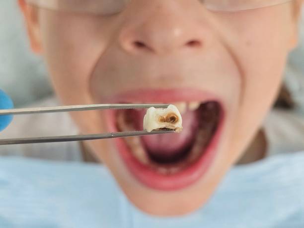 Best Pediatric Emergency Dentist in Nescopeck, PA